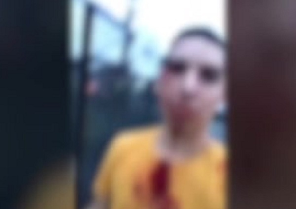 Hombre agredido por cuidacoches - C9N
