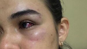 Golpeó a sus vecinas porque creyó que ladrón se escondió en casa de ellas