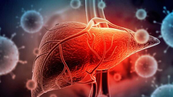¿Cuáles son los síntomas del nuevo tipo de hepatitis infantil aguda?
