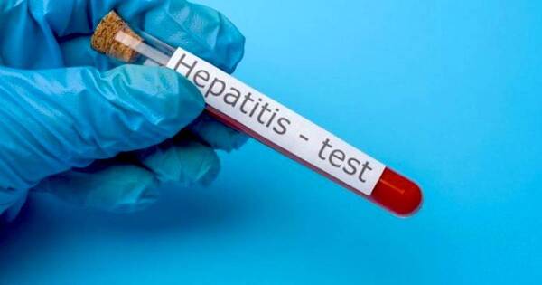 La Nación / Todos están expuestos a contraer la hepatitis