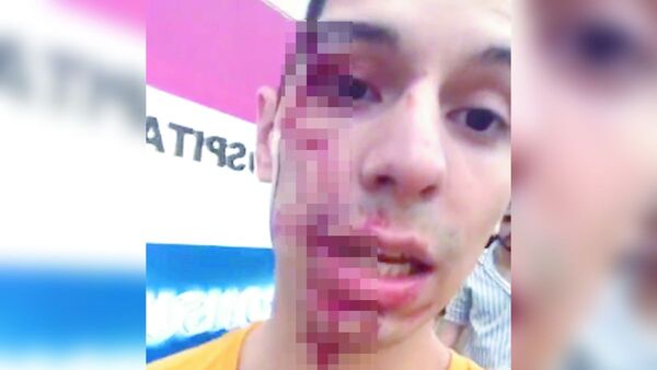 Cuidacoches atacan a jóvenes al salir de bar