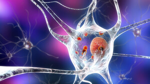 Diario HOY | Identifican qué células cerebrales mueren a causa de la enfermedad de Parkinson