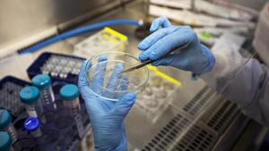 Diario HOY | Hallan nueva terapia frente al cáncer de páncreas