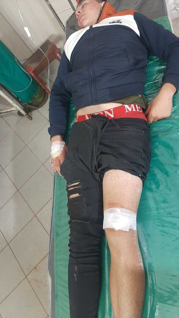 Cumpleaños casi terminó en tragedia en Alto Verá: Hombre efectuó disparos al aire e hirió a un joven
