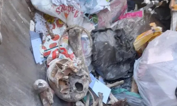 Un trabajador encontró huesos y cráneos humanos en bolsa de basura - OviedoPress