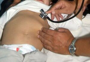 Brasil crea central para investigar causas de hepatitis infantil aguda - Mundo - ABC Color