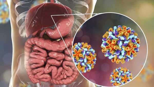 Hepatitis Aguda: aún no se identifica el causante de la enfermedad - El Independiente