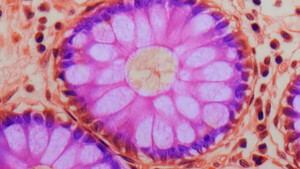 Diario HOY | Científicos avanzan en el mapeo de casi todos los tipos de células del cuerpo humano