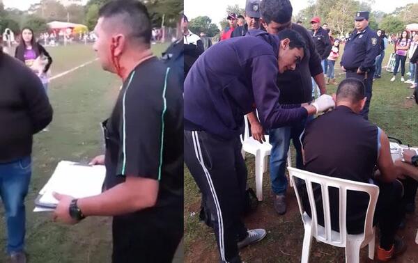 Ovetense fue agredido tras arbitrar un partido en San Joaquín – Prensa 5