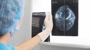 Diario HOY | Un análisis de sangre permite detectar en forma temprana el cáncer de mama y de próstata