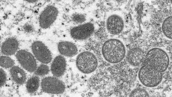 Diario HOY | Perú se declara en alerta sanitaria por la viruela del mono