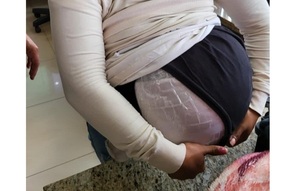 'Embarazo falso': Cruzó a Brasil con marihuana pegada a su panza y la descubrieron