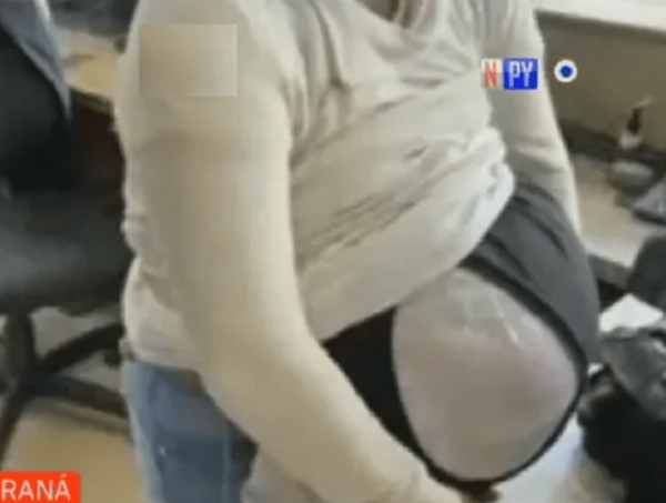 Detienen a mujer que estaba "embarazada" de semillas de drogas · Radio Monumental 1080 AM