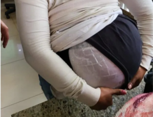 Mujer cruza al Brasil con paquetes de marihuana como panza de embarazada - El Independiente