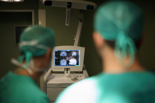 Más de 700 personas esperan un transplante renal en Perú - MarketData