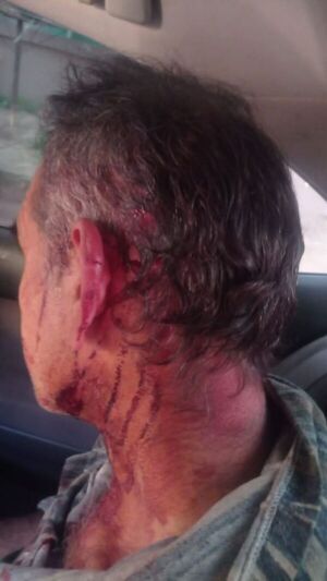 Joven macheteó en la cabeza a trabajador en CDE