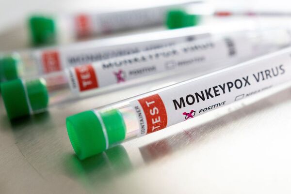 Diario HOY | Antivirales podrían reducir la duración de los síntomas de viruela del mono