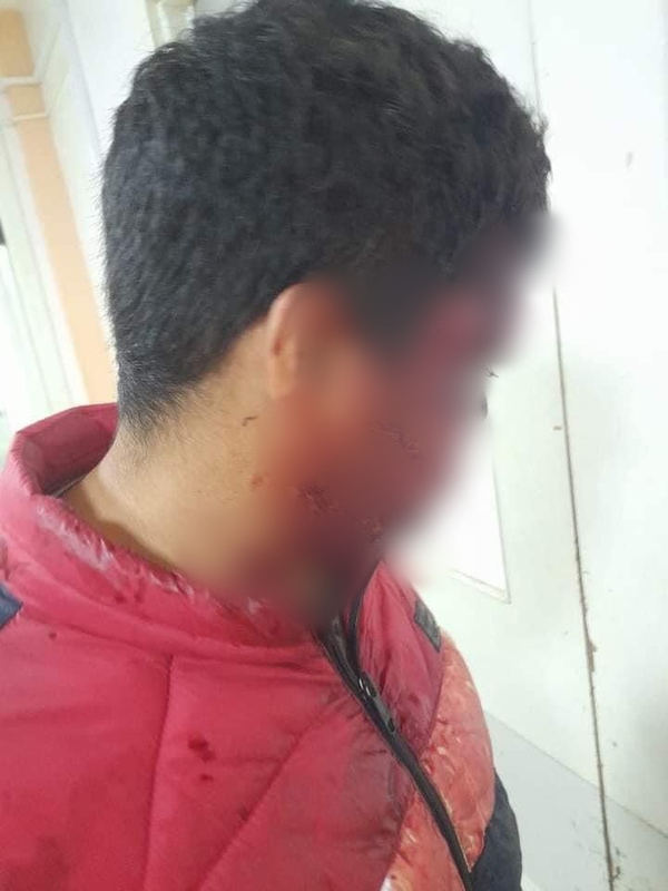 Puente en malísimo estado casi ocasiona tragedia en CDE - La Clave