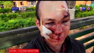 Desfiguran el rostro a joven menonita | Noticias Paraguay