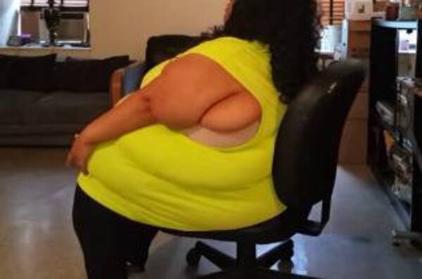 Crónica / La OMS advierte el sarambi que la obesidad les crea a las mujeres
