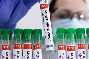 Diario HOY | Se confirmó el primer caso de viruela del mono en la Argentina