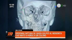 Fiscalía ordena captura de menonita que agredió brutalmente a otro