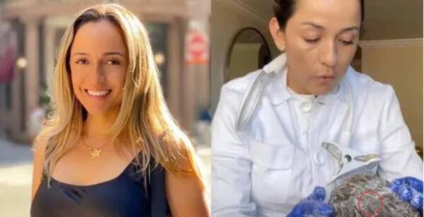 Mujer gana una fortuna en EEUU por eliminar piojos