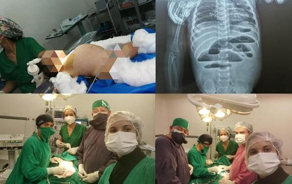 Lactante con invaginación intestinal que era tratada por “medico ñana” fue operada de urgencia en Coronel Oviedo – Prensa 5