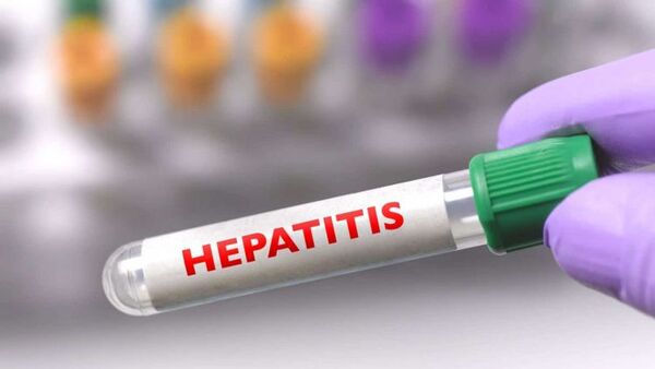 Colombia confirma el primer caso de hepatitis aguda grave de origen desconocido