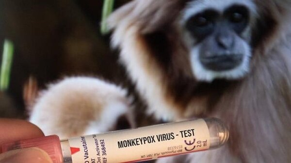Salud investiga posible caso de viruela del mono | Noticias Paraguay