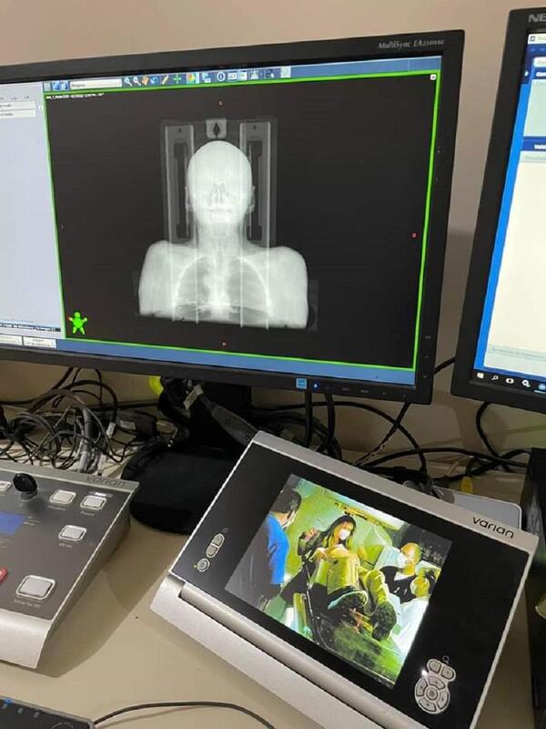 Buena noticia para los pacientes con cáncer ya que existen nuevas técnicas de radioterapia – Prensa 5
