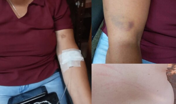 Joven golpeó a su mamá porque no quiere que tenga nueva pareja - Noticiero Paraguay