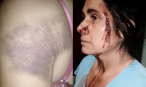 Mujer fue agredida por su vecino y reclama acción de la Justicia - OviedoPress