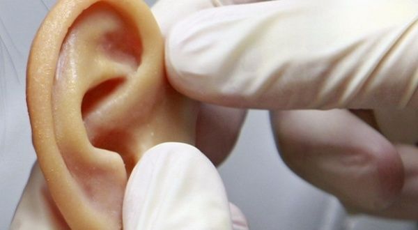 Cirujano implanta en paciente oreja impresa a partir de células humanas