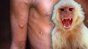 Ola de contagios de viruela del mono llegó a 700 casos en el mundo