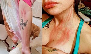 Sobrina es brutalmente golpeada por su tío en Minga Guazú, en caso con trasfondo más grave – Diario TNPRESS