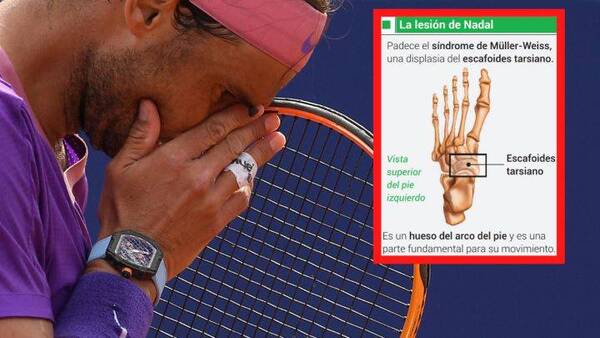 Crónica / Rafael Nadal podría caminar con dificultad el resto de su vida