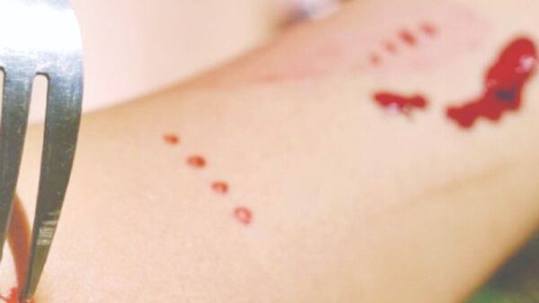 Con tenedor clavó a su ex, él no aceptaba al novio nuevo