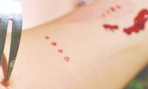 Clavó a su ex con tenedor porque no aceptaba al novio nuevo - OviedoPress
