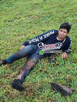 Hombre fue herido de bala en la pierna