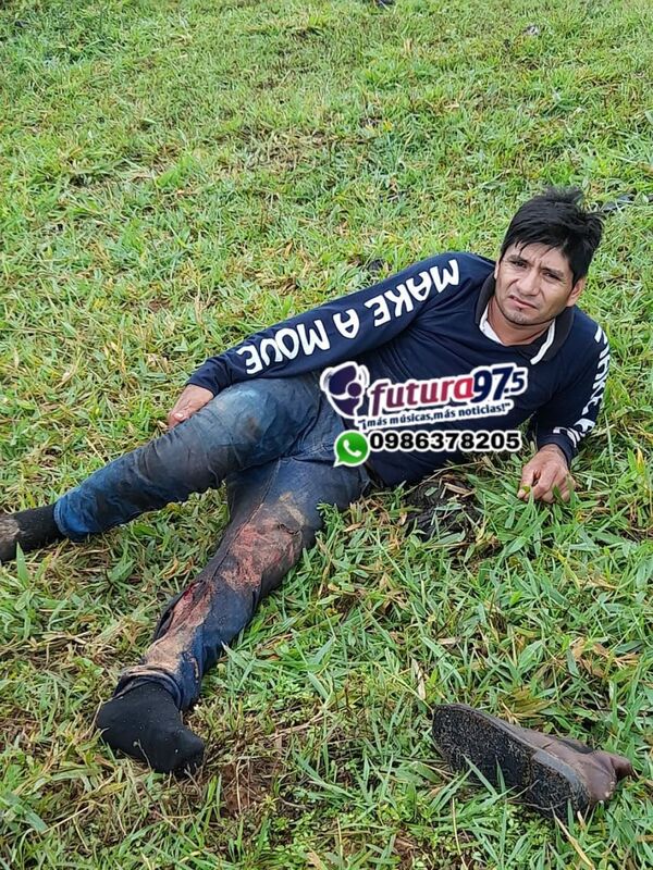 Hombre fue herido de bala en la pierna