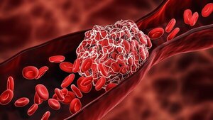 Piden ayuda económica para comprar medicamento a paciente con enfermedad rara de la sangre