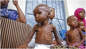 Las otras víctimas de la guerra Rusia-Ucrania: niños en el cuerno de África | 1000 Noticias