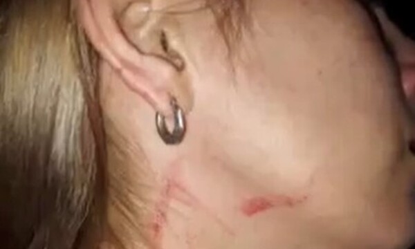 Joven denuncia maltrato por parte de su pareja - C9N