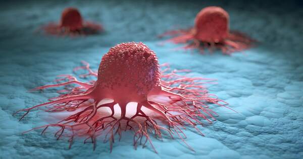 Por primera vez, un medicamento logra remitir el cáncer en todos los pacientes de un estudio | 1000 Noticias