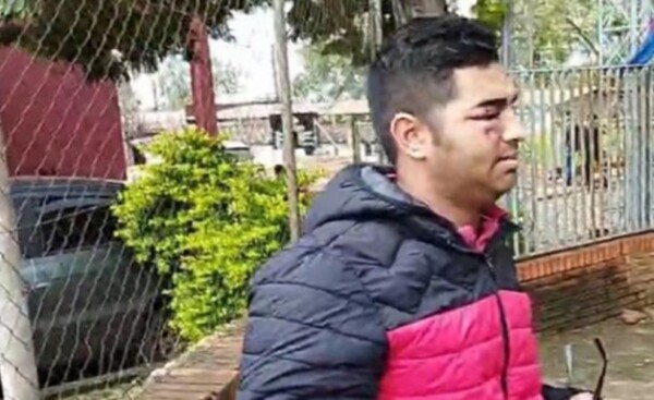 Piden rebeldía de hombre que arrancó el ojo a un joven