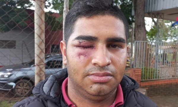 Fiscal imputa y pide la rebeldía de hombre queagredió brutalmente a joven con botella de vidrio – Diario TNPRESS