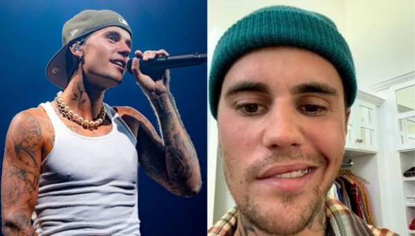 ¿Síndrome de Ramsay Hunt? Lo que debés saber del padecimiento de Justin Bieber - Megacadena — Últimas Noticias de Paraguay