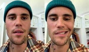 Crónica / [VIDEO] Justin Bieber mostró cómo le tiene la parálisis facial
