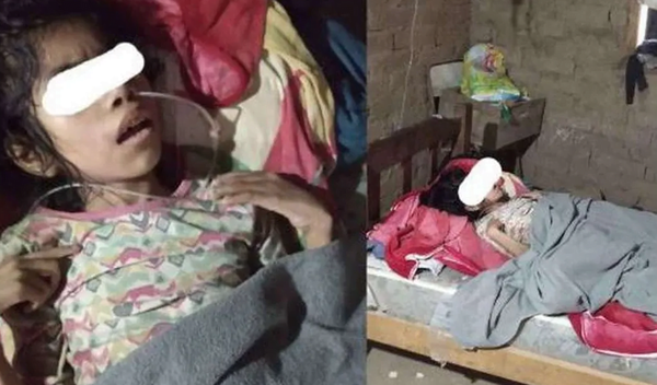 Tiene 12 años, es huérfana, está postrada y los chanchos le comieron los dedos - Noticiero Paraguay
